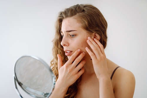 Come Prevenire le Macchie sul Viso e Rimedi per Una Pelle Luminosa